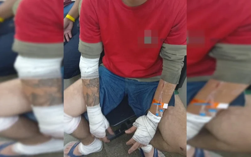 Motociclista tem baço fraturado após acidente com carro no DF
