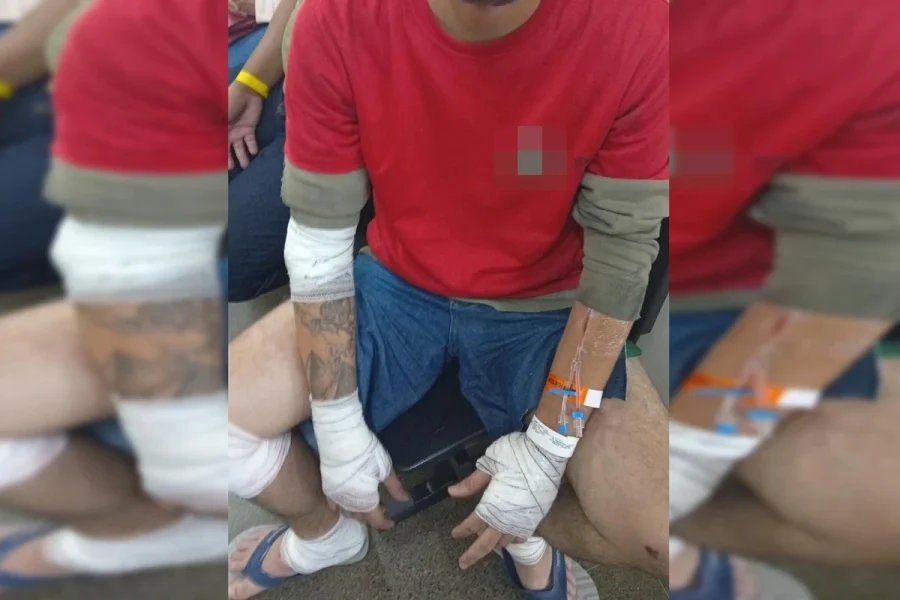 Motociclista tem baço fraturado após acidente com carro no DF